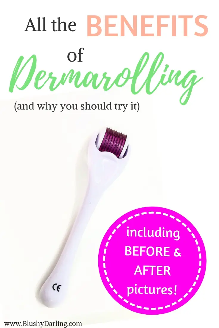 See the results I got using a dermaroller on my skin to get rid of acne scars and wrinkles at home. #makeup #Beauty #blogger
