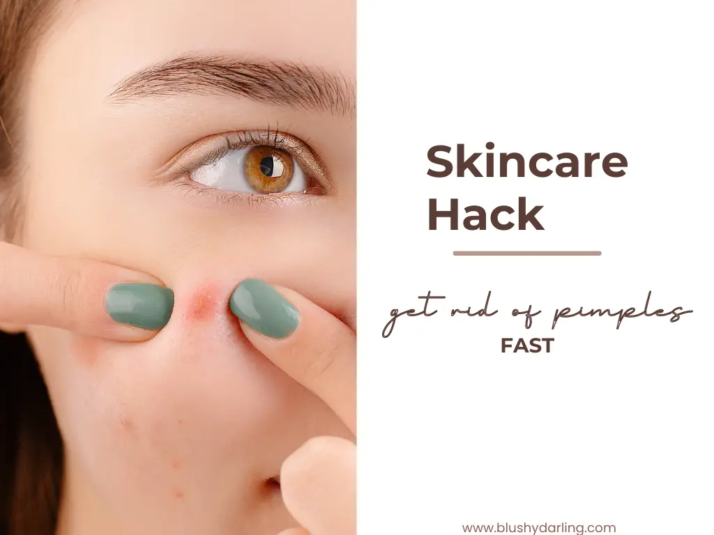 Skincare Hack | Get Rid Of Pimples Fast
